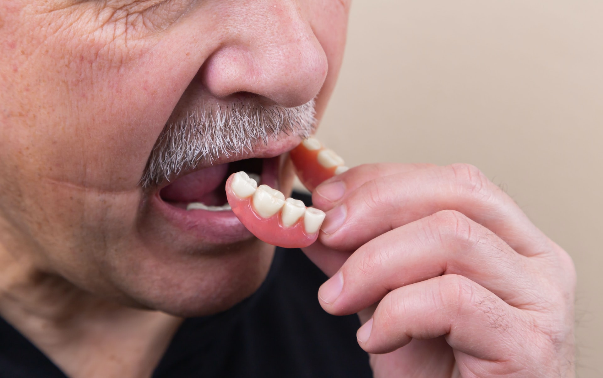 partial and full dentures - man putting dentures in mouth